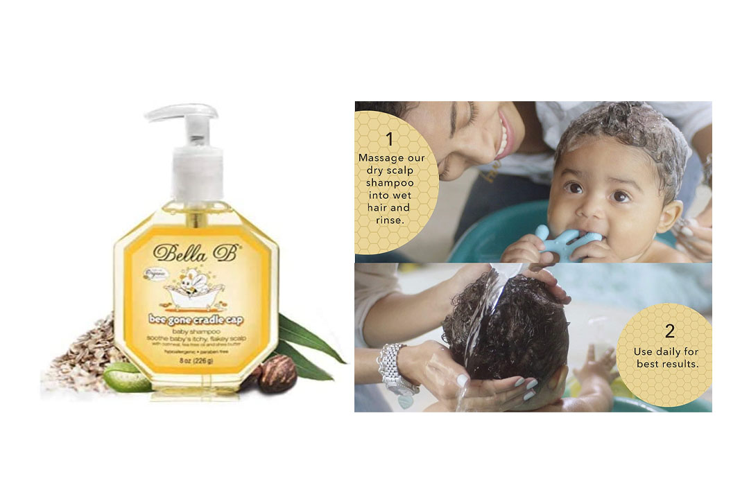 Bella B Bee Gone Cradle Cap Baby Shampoo