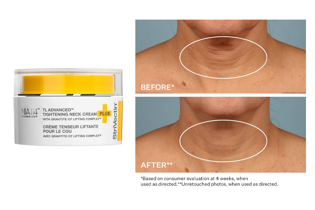 StriVectin TL Advanced Tightening Neck Cream