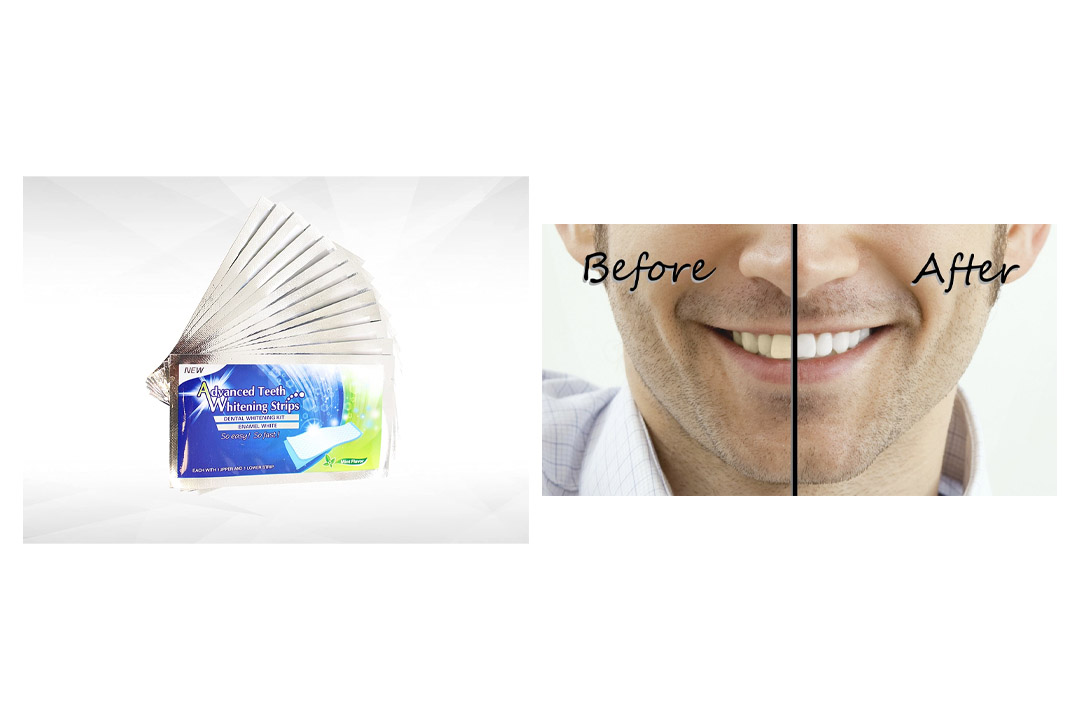 Teeth Whitening Strips