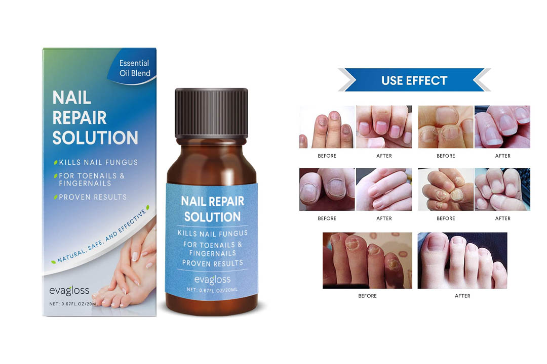 Fungus Stop, Natural Anti-fungal Nail Solution